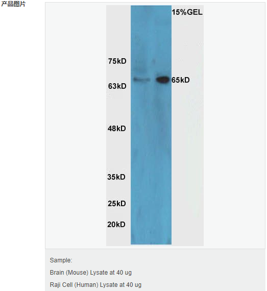 6052ab5b23de9.png image.png