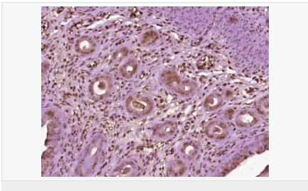 6052b273ec15b.png image.png