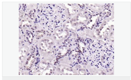 6052bc38dd3d8.png image.png