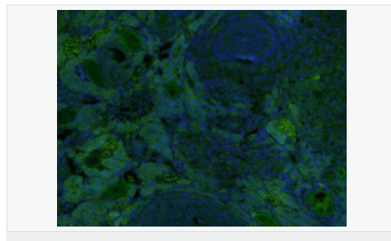 60545988c79a8.png image.png