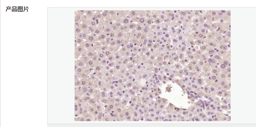 6057fbe0cf3f1.png image.png