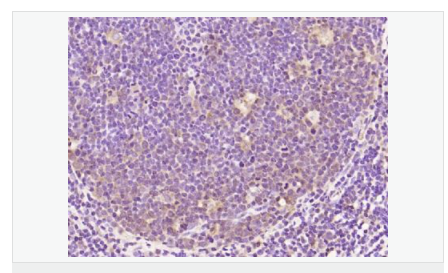 605852c123eb7.png image.png