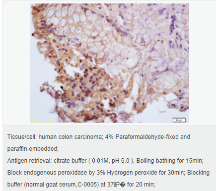 605952db1d228.png image.png