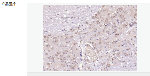 6059533f03d4f.png image.png