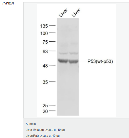 605999e7570e5.png image.png