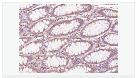 6063d6341f623.png image.png