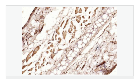 6066795e773e8.png image.png