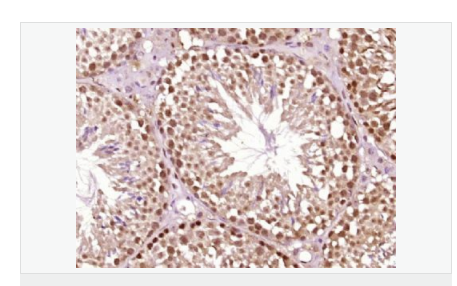 6076464071ecc.png image.png