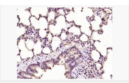 6076468915b1b.png image.png