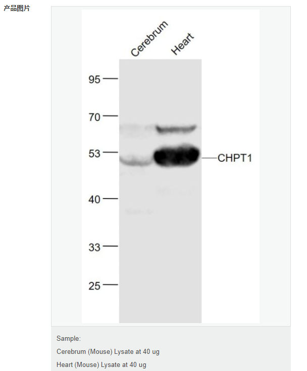 6077b069d3c2b.png image.png